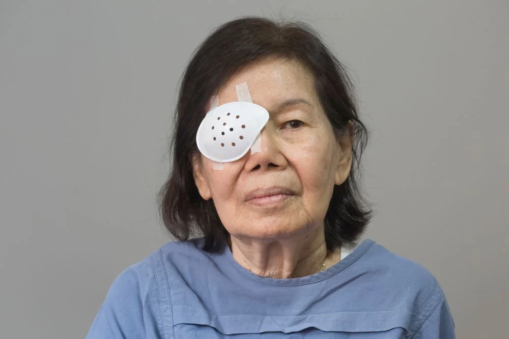 Can Cataract Surgery Affect the Retina? What to Know About Post-Op Retinal Risks