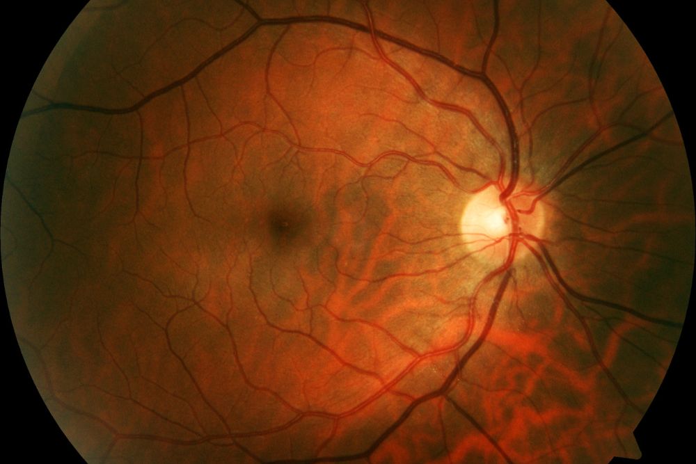 Exploring the Retinal Vascular System