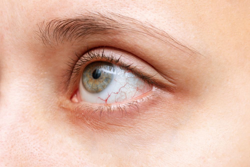 The Connection Between Autoimmune Diseases and Uveitis